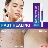 wart removal pen treatment filamentous warts freckle mole correcting blemishes softening keratin essence painless face body care
