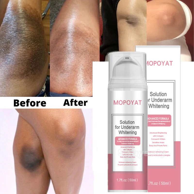 

Armpit Whitening Cream Skin Lightening Bleaching Cream For Underarm Dark Skin Legs Knees Whitening Intimate Body Care