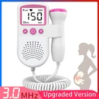 Улучшенный цветной допплер с ЖК-дисплеем, устройство для отслеживания сердечного ритма плода, детектор сердечного ритма плода для беременных и детей, детектор сердечного ритма без излучения, 3,0 МГц