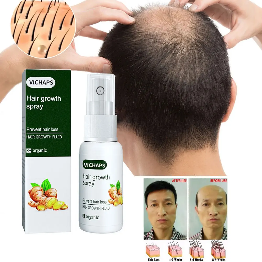 

Ginger Hair Growth Essential Oil Natural Anti Hair Loss Products Fast Grow Prevent Baldness Treatment Germinal Liquid Men Women