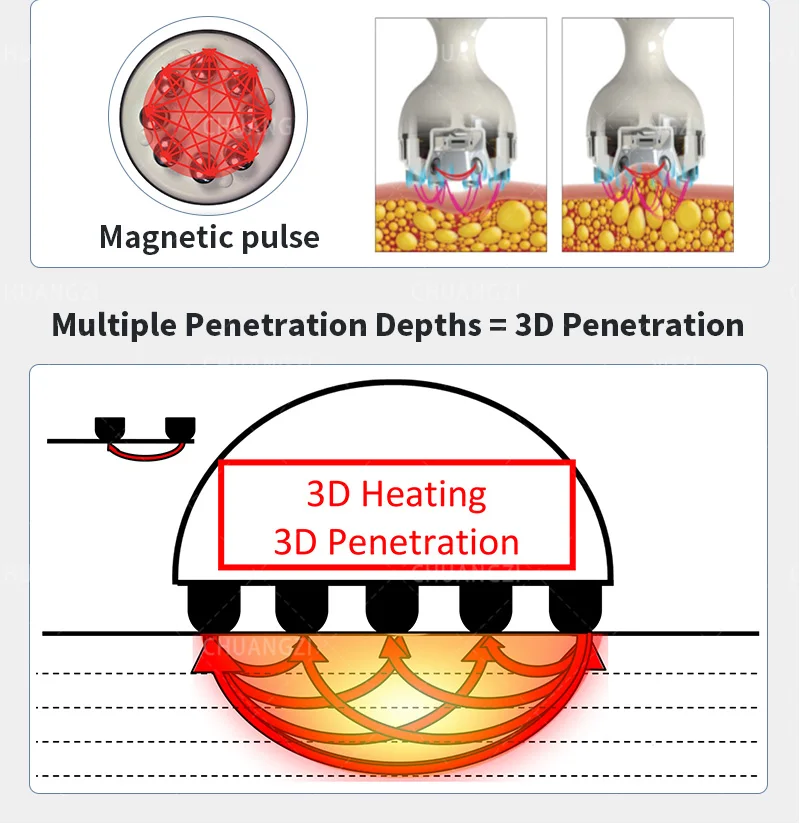 Рисунок 4 - VENUS LEGA-C 4D RF вакуумный аппарат