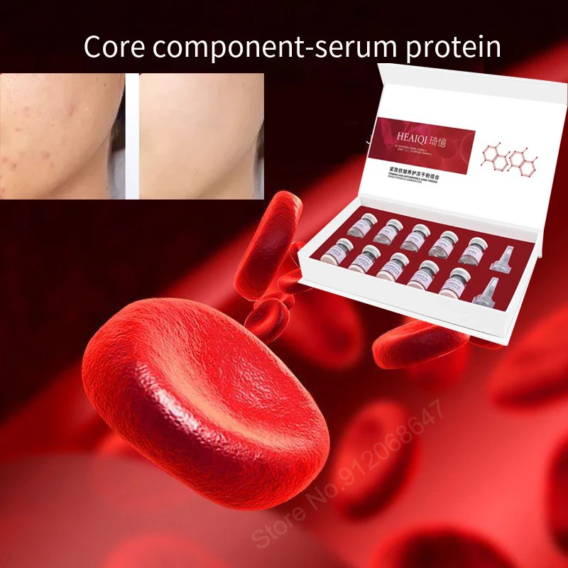 Сыворотка протеин подкожное масло для детей лица жидкость тела кинетическая