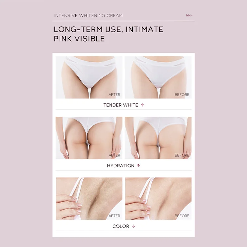 Отбеливающий крем уход за кожей тела осветляющий лосьон для лица и отбеливающий