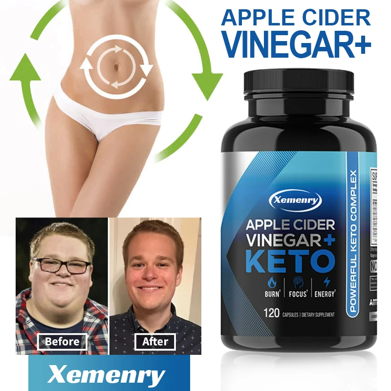 

Apple Cider Vinegar Capsules Ketones + BHB, Fat Burner and Weight Loss Supplement, Appetite Suppressant for Women and Men