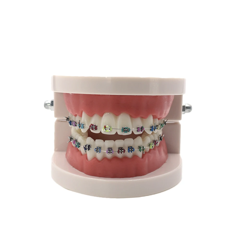 

1 Pc Dental Teeth Model #5006 Metal Ceramic Bracket Tube Self-ligating Chain