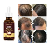 hair growth essence anti fall promote hair growth nursing oil control deep nourishment moisturize hair follicles hair care 30ml