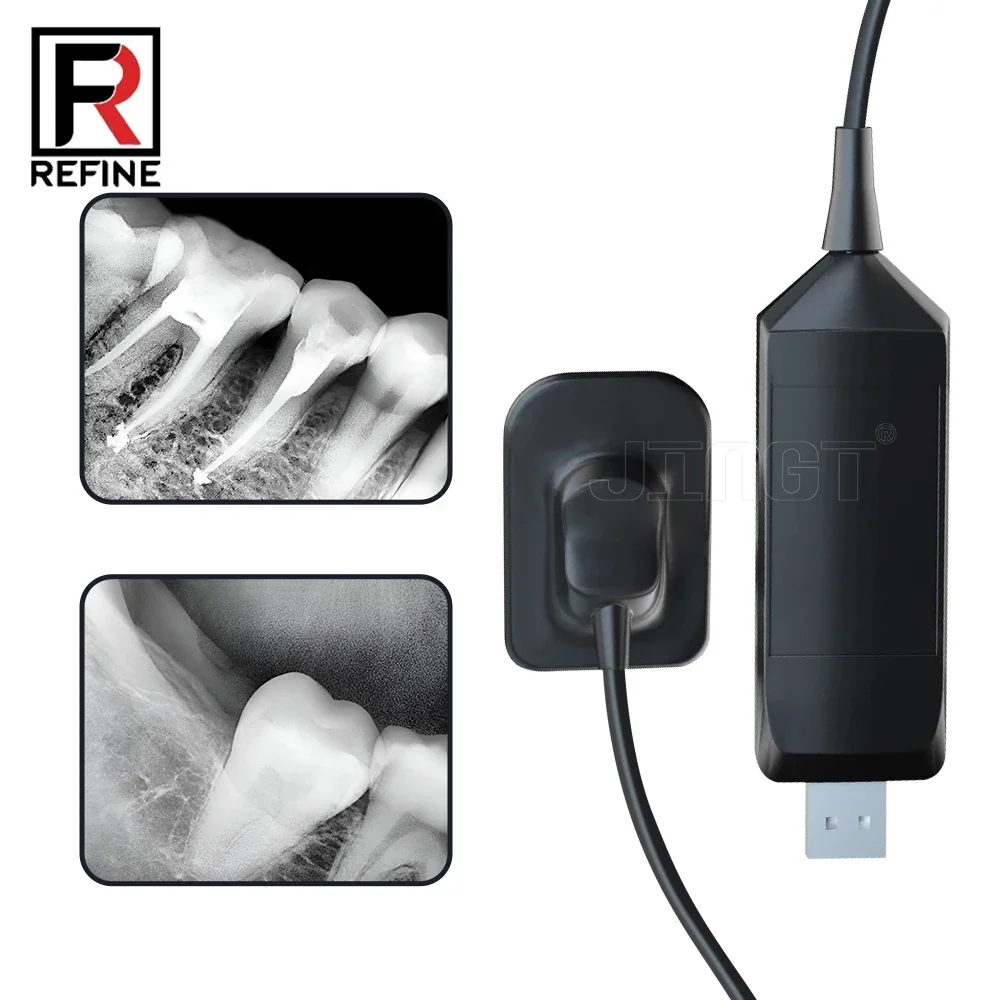 Фото Стоматологический рентгеновский датчик REFINE Radiovisograph Rx, цифровое прозрачное стоматологическое радиофографовое оборудование, HD-изображение, внутриротовая цифровая система №3