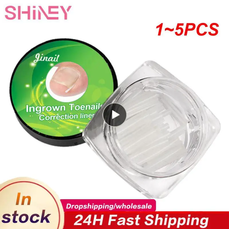 

1-5 шт., корректор для ногтей, вросших ногтей