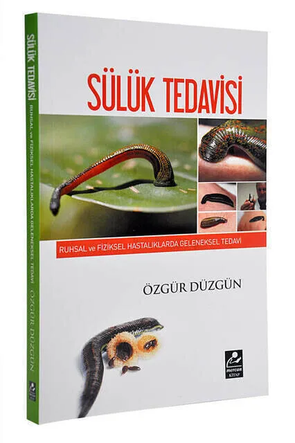 

IQRAH Leech Therapy Book (Free Smooth)-1576