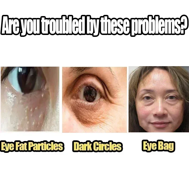 Крем для области вокруг глаз от Тёмных кругов и мешков под глазами