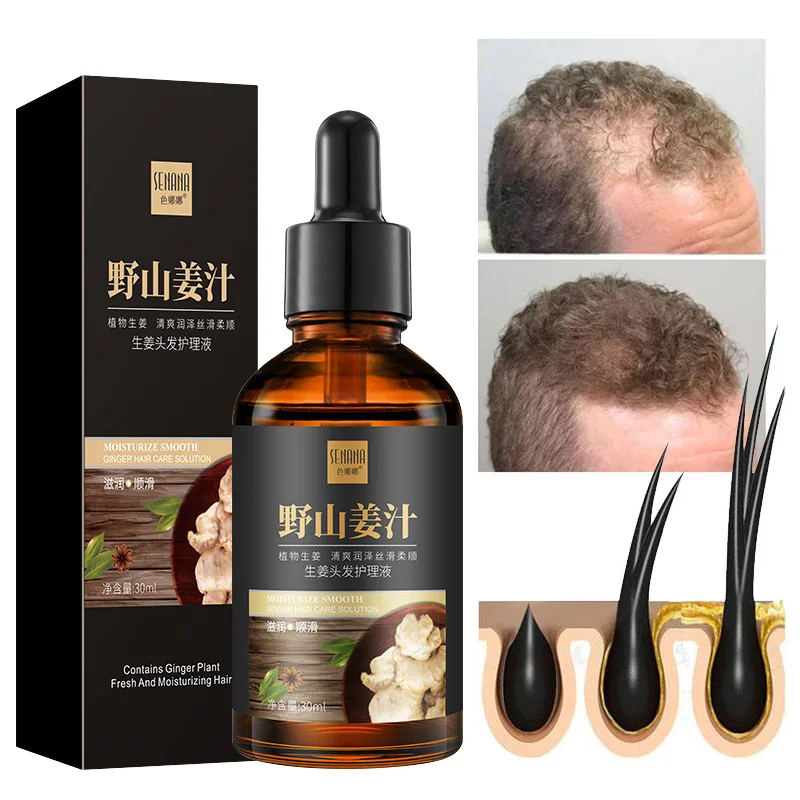 

Ginger Hair Growth Serum Fast Growing Anti Hair Loss Essential Oil Beauty Hair Care Prevent Baldness Scalp Treatment Men Women