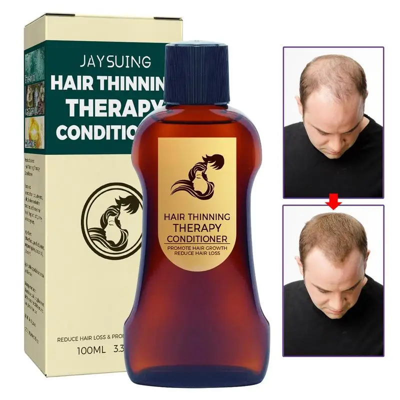 

Anti Hair Loss Conditioner Moisturizing Conditioner for Hair Thickening Mild Hair Care Products for Frizzy Damaged Dry Oil Curly