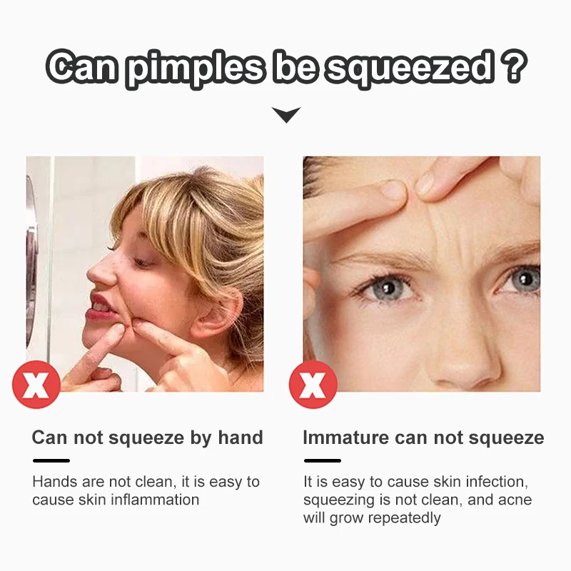 Blackhead Acne Remover Tool Stainless Steel Needles Comedone Black Spot Pimple Treatment For Face Skin Care Facial Pore Cleaner |