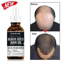 organic black seed hair oil for fast hair growth ginger anti hair loss essential oil promote hair regrowth serum hair care