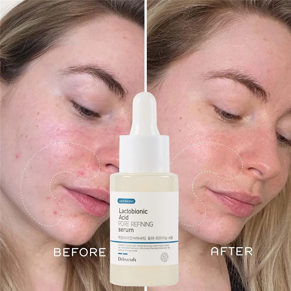 

Сыворотка лактобионовая кислота для сужения пор эсенция для лица корейский уход за кожей Гиалуроновая кислота увлажнение контроль жирност...