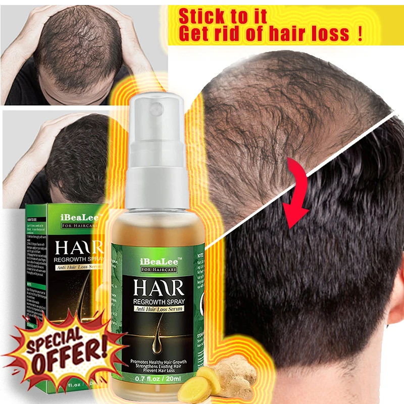 

Sdotter Natural Hair Growth Products Essential Oils Hair Care Essence Spray Hair Loss Liquid Health Care Hair Growth SerumFor Me