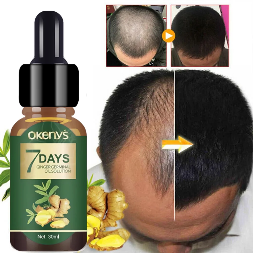 Hair Growth Essential Oils Products 7 Days Ginger Germinal Anti Hair Loss Serum Care Nourish Scalp Repair Dry Frizzy Hair Essenc