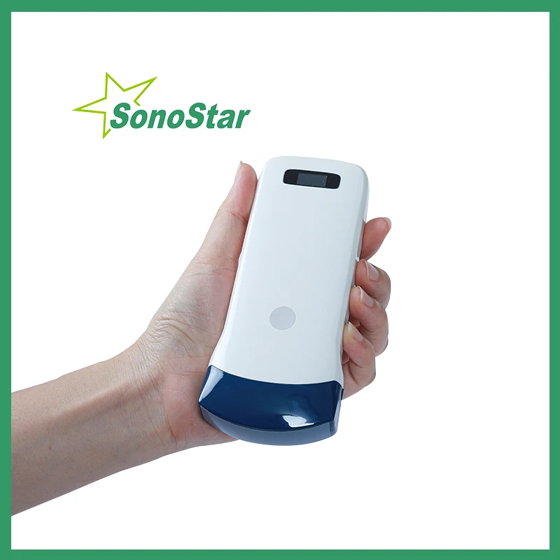 Фото Sonostar беспроводной ультразвуковой выпуклый зонд сканер портативный аппарат WIF USG ручной 3,5/5 МГц цветной доппплер 128 элемент sono №3