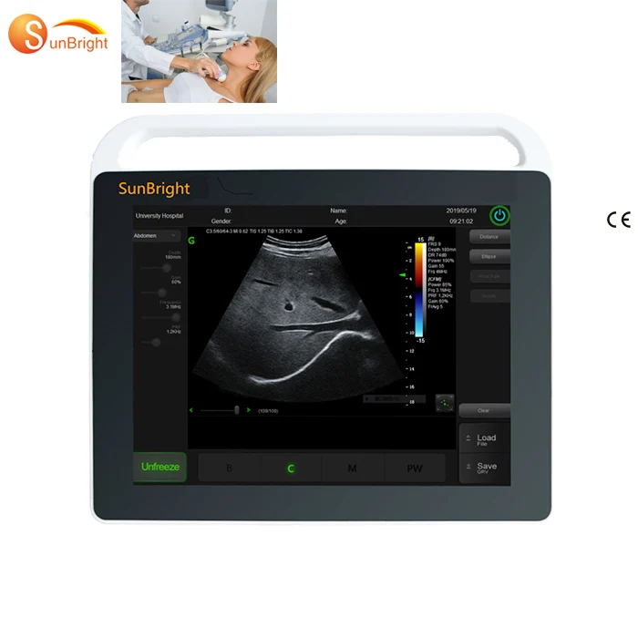 

Touch screen handheld machine portable tablet medical ultrasound scan ultrasound