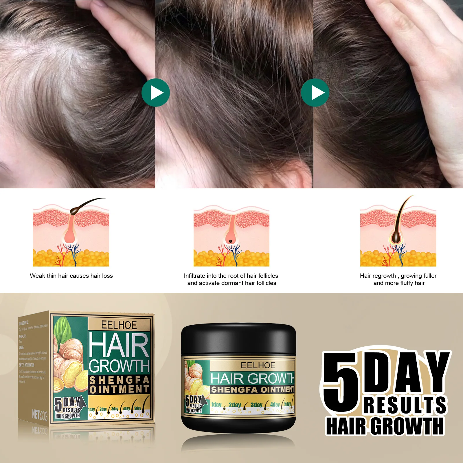 Ginger hair care cream for hair growth, dandruff removal, itching relief, stimulation of hair follicle regeneration, suppleness