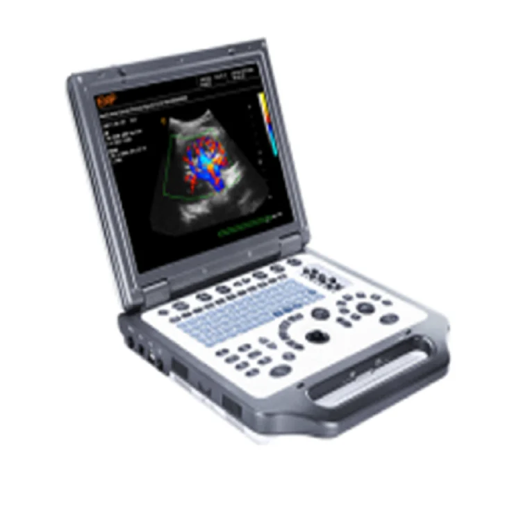Рисунок 6 - Карманный Ультразвуковой портативный