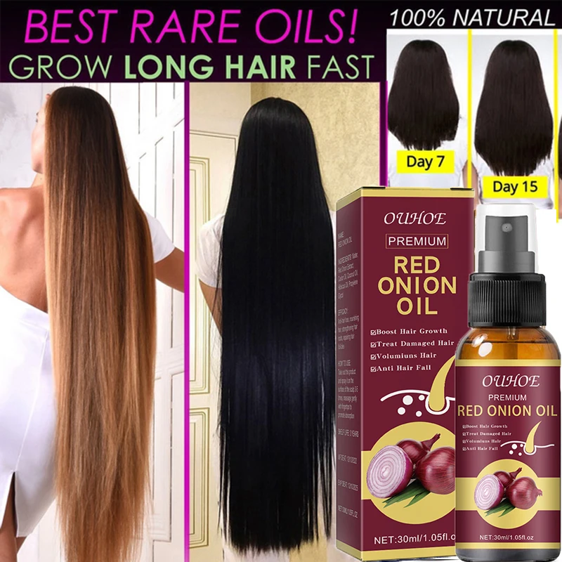 

Onion Hair Growth Spray Products Fast Growing Hair Natural Anti Hair Loss Prevent Hair Dry Frizzy Damaged Repair Care Men Women