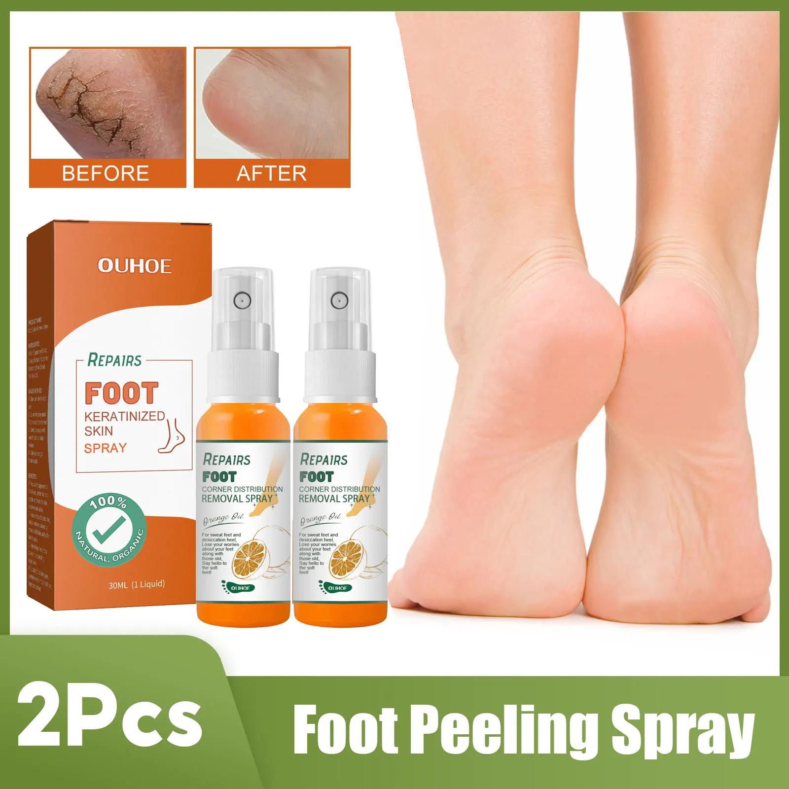 

Foot Peeling Spray Dry Dead Skin Removal Callus Pedicure Exfoliating Anti Crack Moisturizing Hydrating Nourish Feet Skin Spray