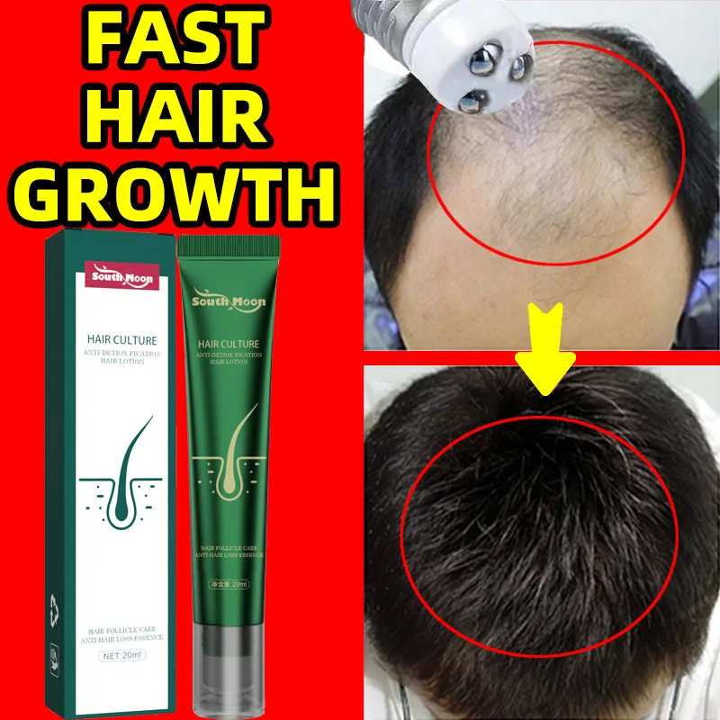 2023 Biotin Fast Hair Growth Oil Regrowth Serum Scalp Treatment Prevent Baldness Anti-Hair Loss Repair Thin Damaged Hair Care