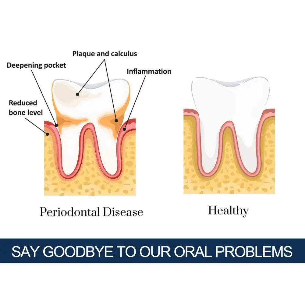 

90ml Reveals a brighter smile, balances tooth tone, hides stains and improves overall brightness.