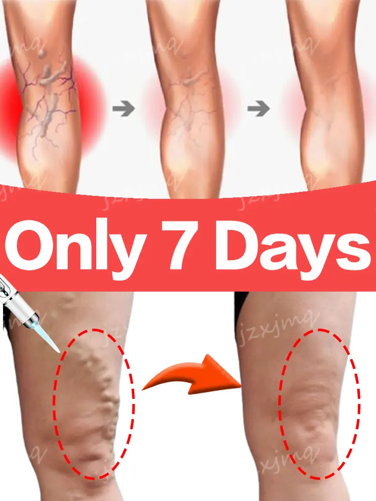 Крем для кожи Varicosse Laser