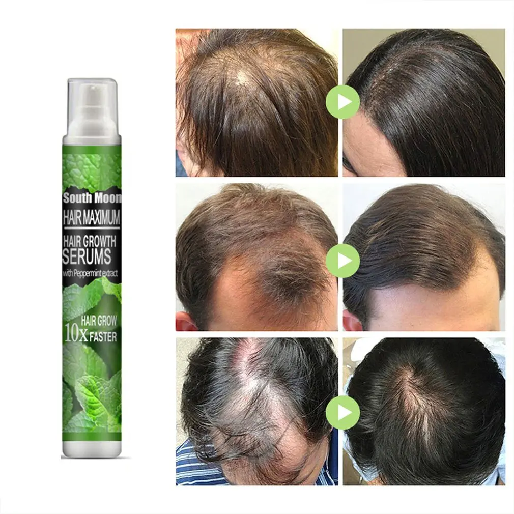 

10ml Hair Growth Fluid Herbal Hair Growth Spray Serum Anti Hair Loss Fast Grow Prevent Hair Dry Damaged Repair Essence Oil