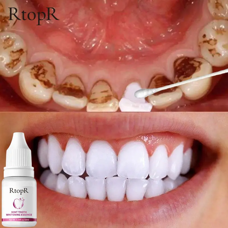 Teeth Whitening Essence Remove Plaque Stains Oral Hygiene Bleaching Products RtopR Cleansing Fresh Breath Dentistry Care Tools