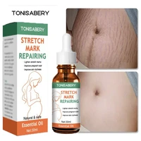 stretch marks remover essential oil maternity repair treatment scar stretch marks acne spots burn surgery body care products