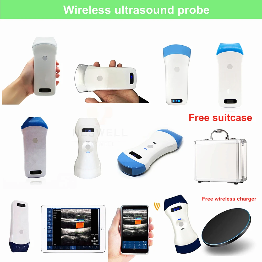 Фото Ультразвуковой сканер Sonostar с Wi-Fi, беспроводной портативный ультразвуковой аппарат с цветным допплером, линейным и конвексным датчиками, поддерживает ISO, Android и Windows. №1