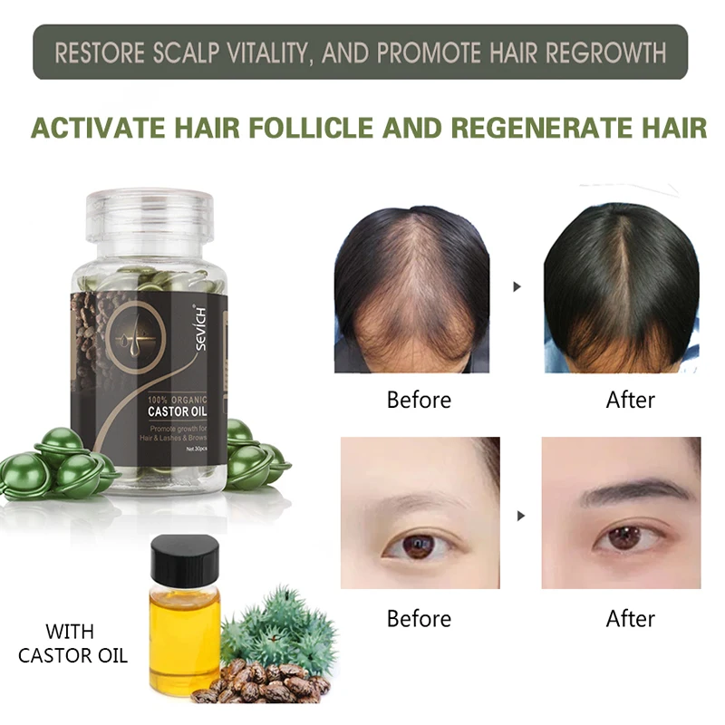 HAIR VITAMIN CAPSULE SMOOTH KERATIN TREATMENT SERUM MASK MOROCCAN OIL REPAIR DAMAGED LOSS ARGAN MOROCCO CARE PRODUCTS ON - Капсулы витаминов для волос, гладкое кератиновое лечение, сыворотка, маска, масло марокканского аргана для восстановления поврежденн