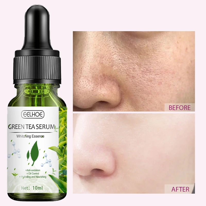 

Green Tea Pore Shrink Face Serum Moisturizing Cream Oil Control Remove Dark Spots Improve Acne Blackheads Dry Skin Care Essence