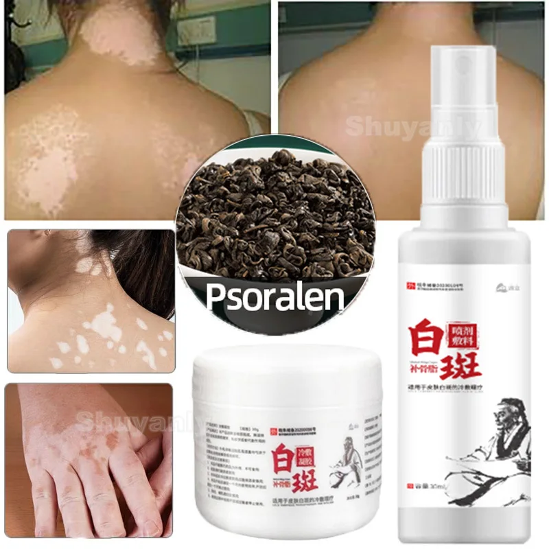 

30ml White Spot Antibacterial Spray 30g Vitiligo Treatment Cream Leukoplakia Disease Promoting Pigment Melanin Medical Plaster