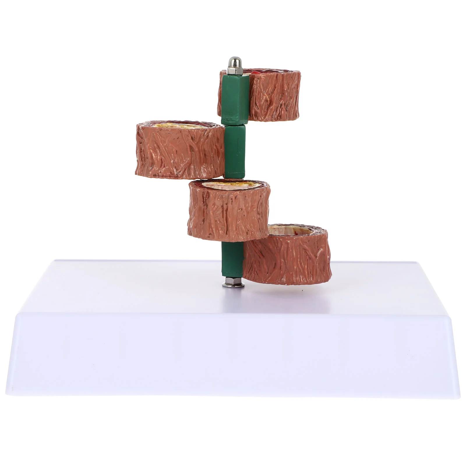 

Vascular Show Model Blood Vessel Model Cardiovascular Model