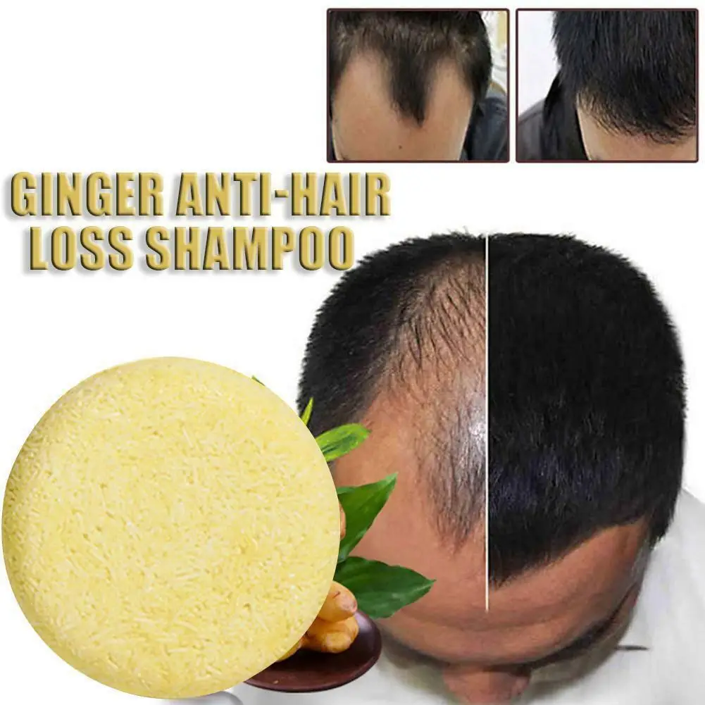 

Sdotter 1 Pc Natural Organic Ginger Shampoo Bar Anti-Itching Cleansing Oil Control Anti Hair Loss Hair Growth Care Soap for Men