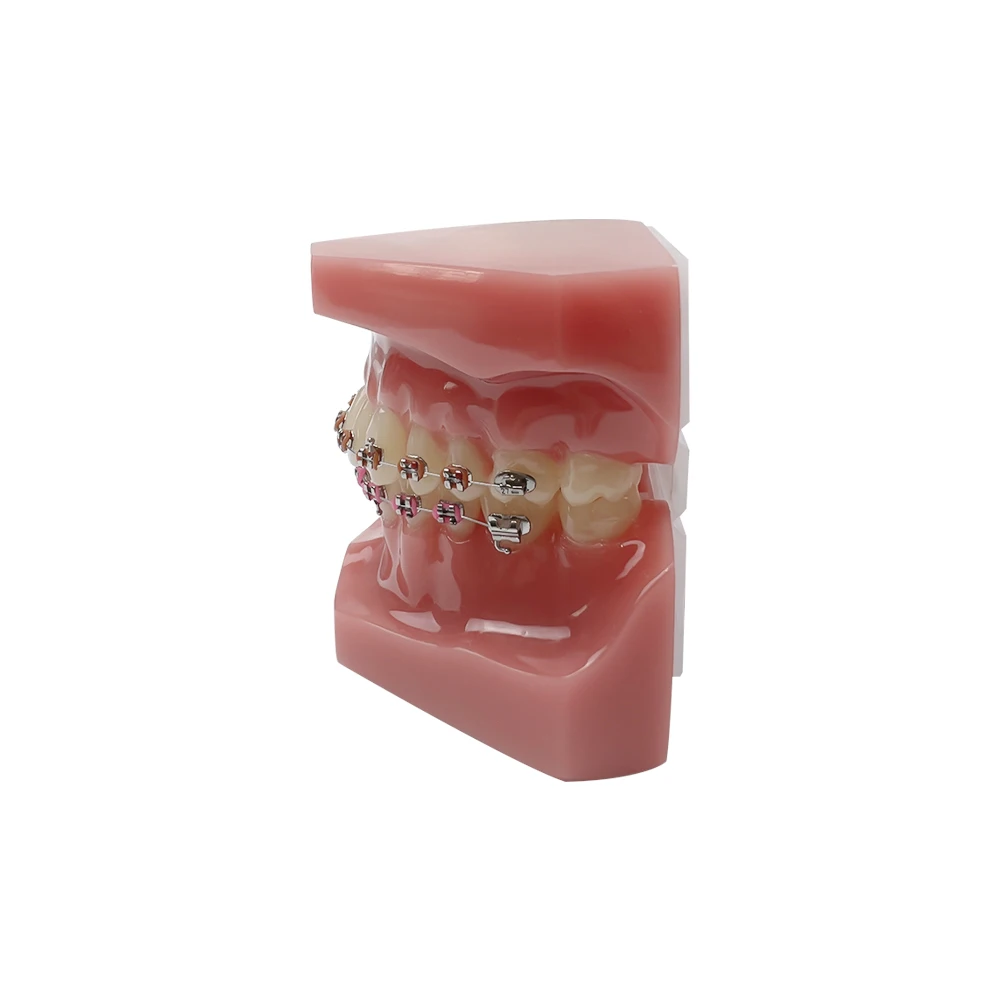 Ортодонтическая стоматологическая обучающая модель с полностью металлическим