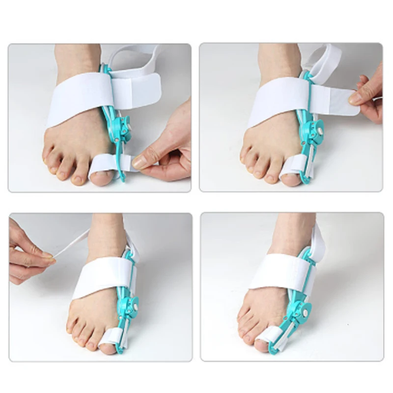 Bunion Straightener Toe Corrector Big Toe Eversion Splint Adjustable Hallux Valgus Corrector Foot Care Pain Relief Tools