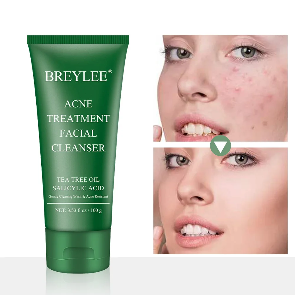 

BREYLEE Facial Acne Treatment Cleanser Remove Blackhead Cleaner Shrink Pore Oil Control Cleansing Wash Mask Face Skin Care