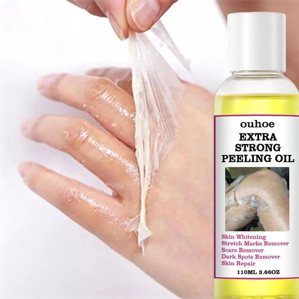 

30/110ML Extra Strong Yellow Peeling Oil Whitening Hands Tone Lighten Even Whiten Care Skin Elbows Knees Skin K7I7