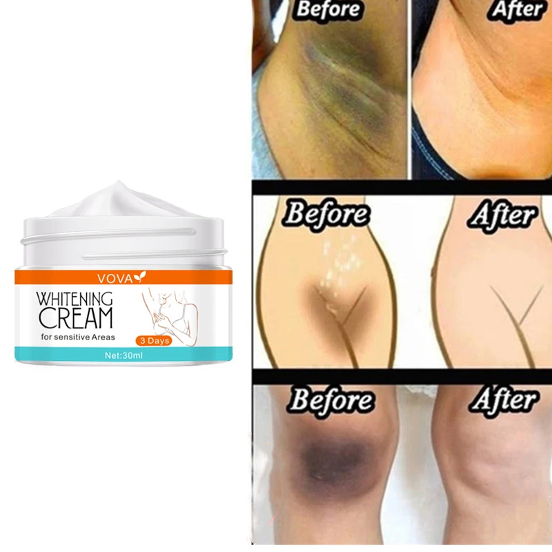 Отбеливающий крем для тела отбеливающая Сыворотка подмышек колен темных точек