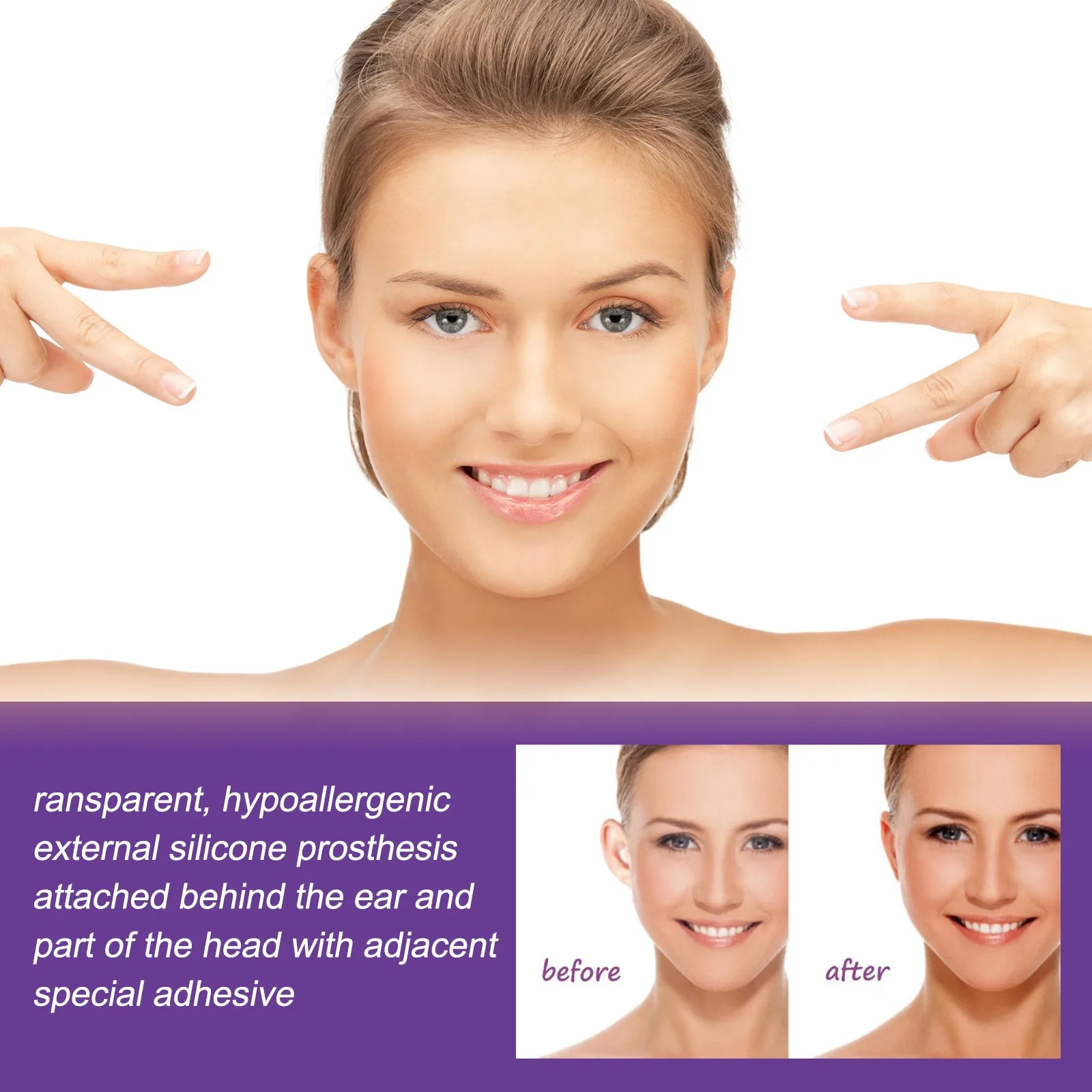 Рисунок 3 - Силиконовые коррекции вальгусной деформации ушей