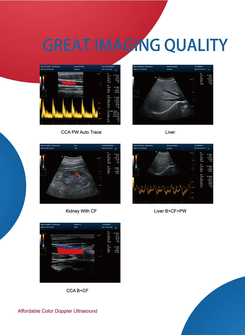 CONTEC CMS1700A-VET Цветной Допплер ветеринарная ультразвуковая сонография