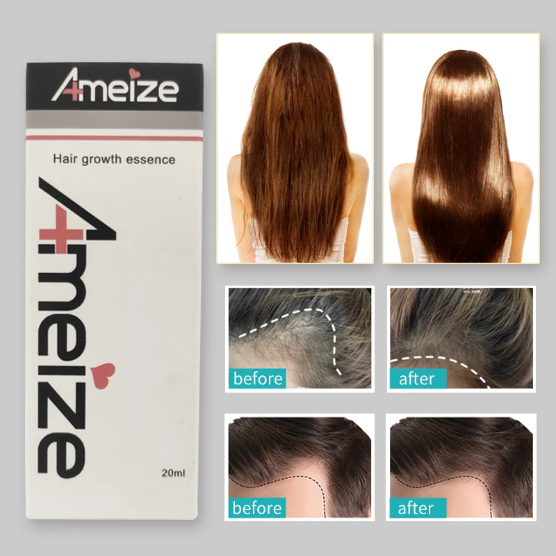 5 шт. масло для роста волос 20 мл