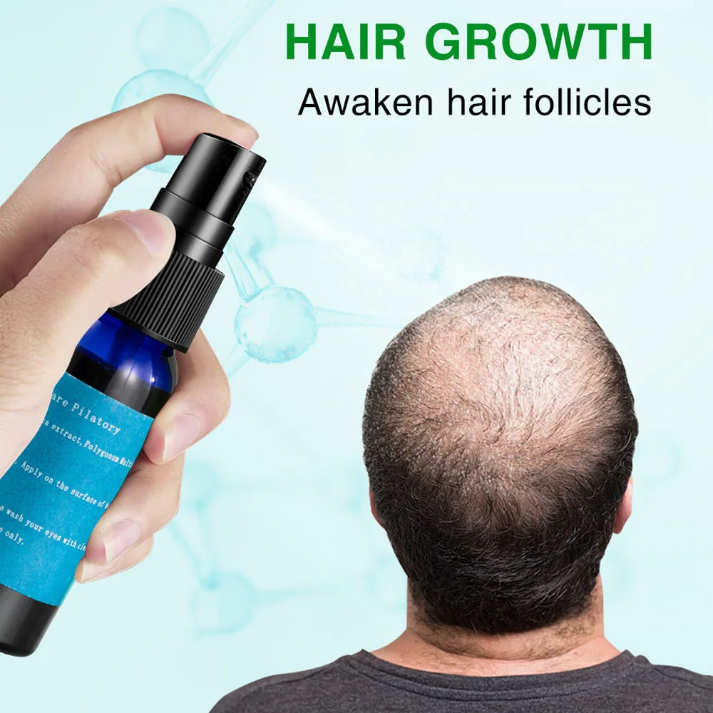 Имбирные продукты для роста волос против выпадения имбирное масло