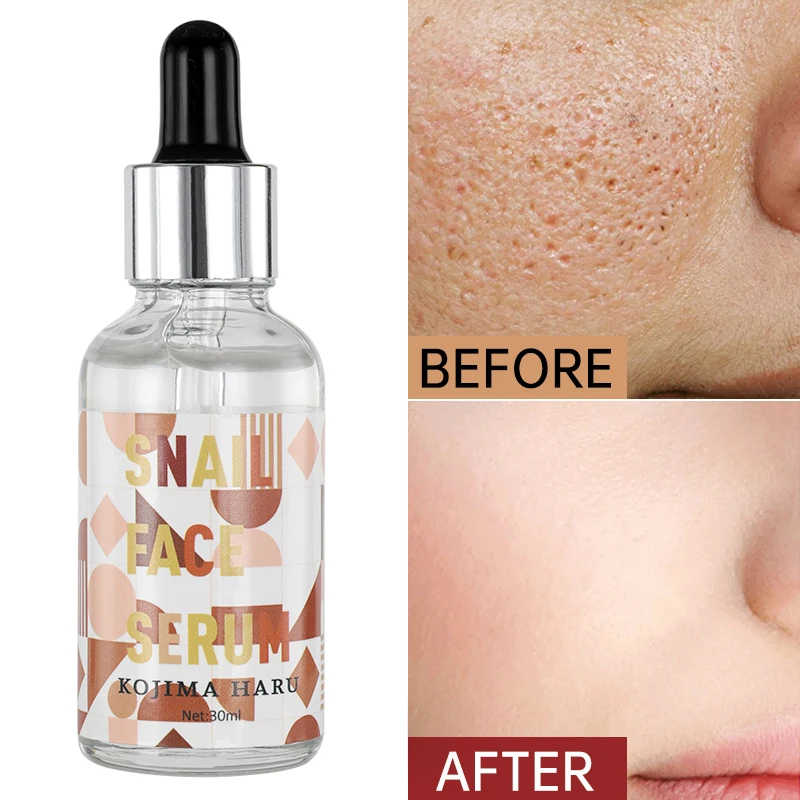 

30ml Snail Serum,Anti Aging & Deep Wrinkles,Heals And Repairs Skin, Instantly Ageless For Face