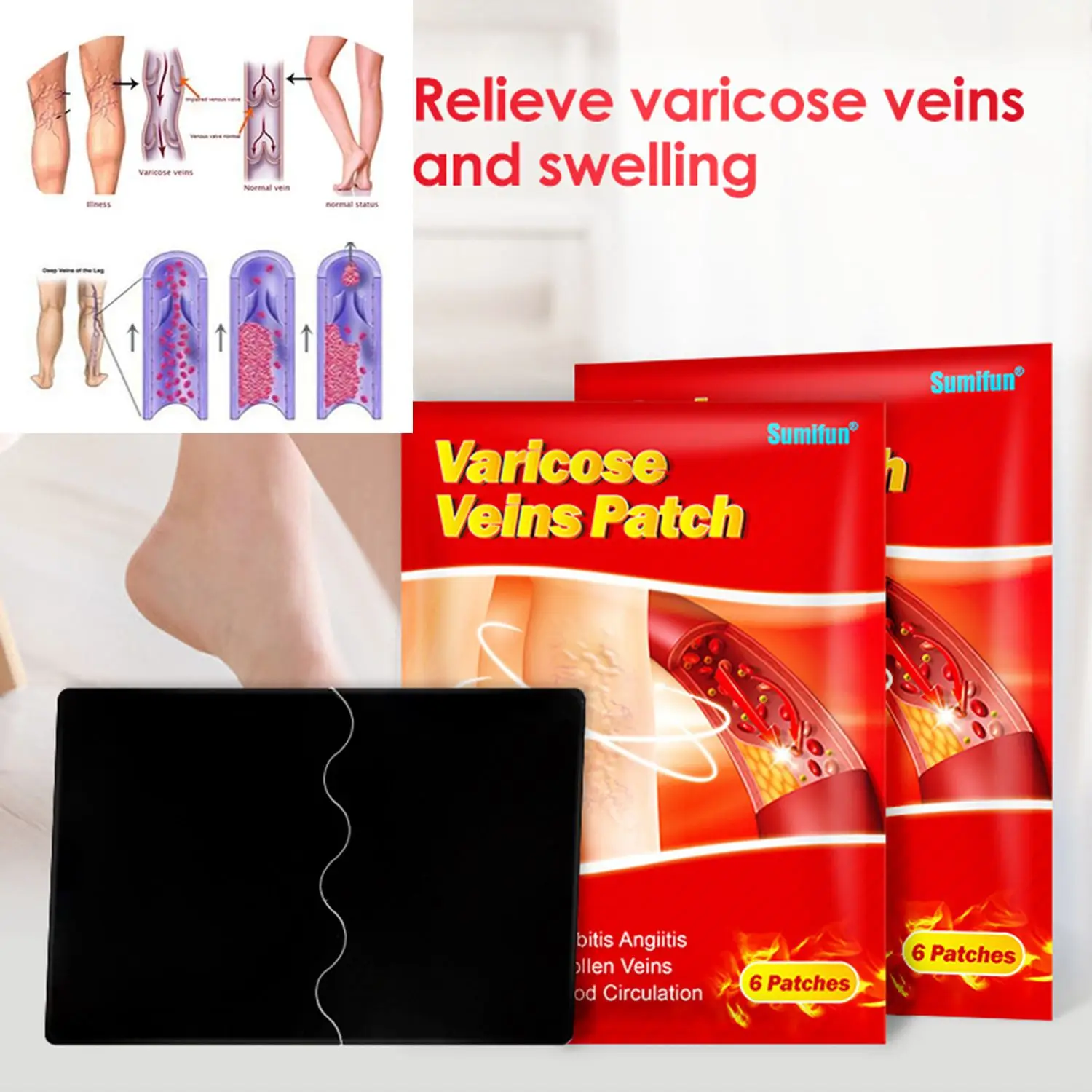 

Эффективный крем от варикозного ангиита, флебита, васкулита, уход за здоровьем, лечение Варикозного расширения вен, патчи, мазь